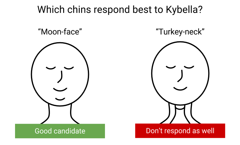 kybella